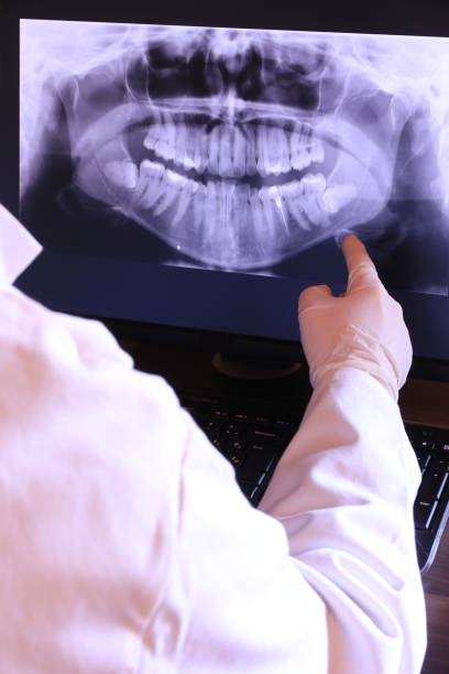 Best Emergency Tooth Extraction in Greensboro, NC