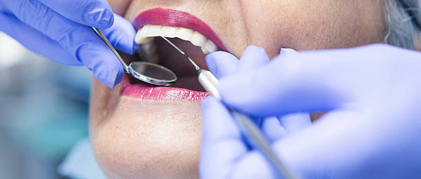 Best Emergency Tooth Extraction in Greensboro, NC